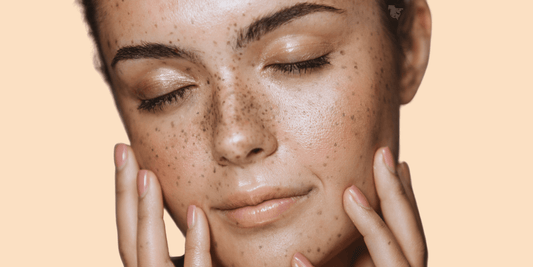 ¿Como elegir la Mejor Crema Hidratante para Piel Seca y Sensible?